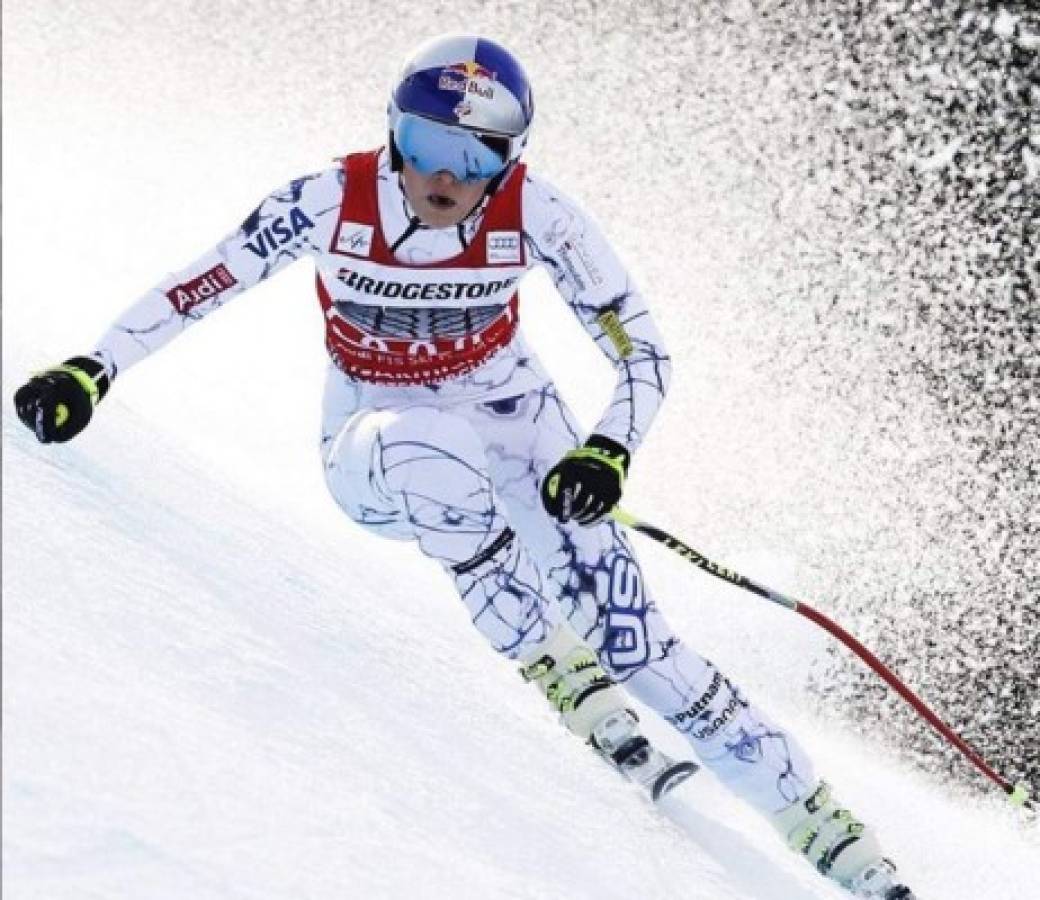 Fotos: Los descuidos de esta bellísima esquiadora por culpa de sus perros