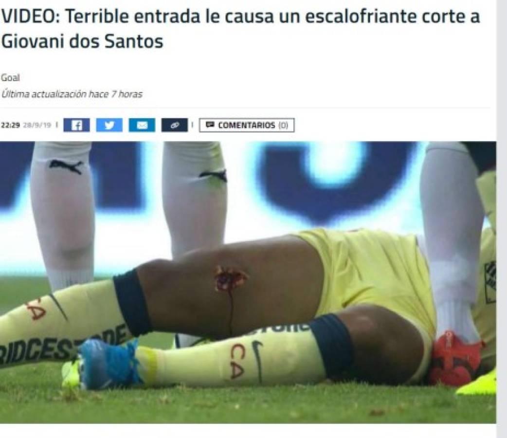 Así reaccionó la prensa mundial tras la grave lesión de Giovanni dos Santos: 'Criminal, de cárcel'
