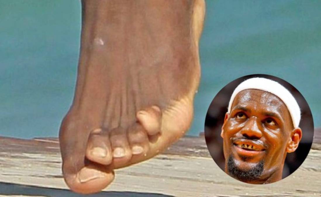 Los pies más horribles de los deportistas famosos