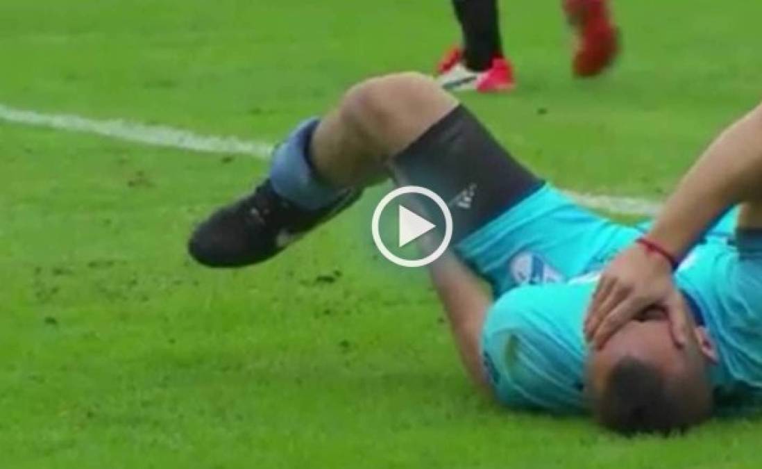 Video: Espeluznante y terrible lesión estremece el fútbol de Argentina