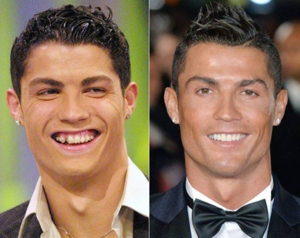 Cristiano Ronaldo: Desvelan las cinco cirugías que se realizó para cambiar su imagen
