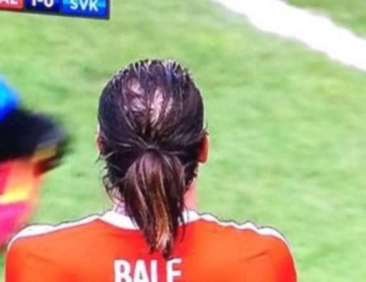Los peinados de Gareth Bale que la alopecia le ha hecho cambiar