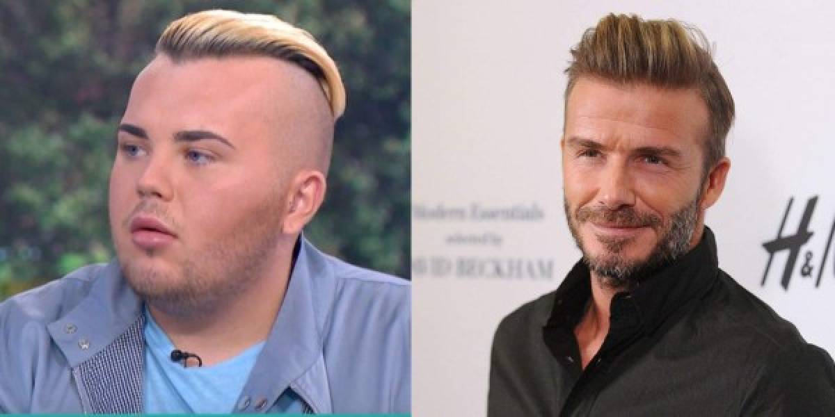 Gasta 25 mil dólares por parecerse a Beckham y el resultado es desatroso