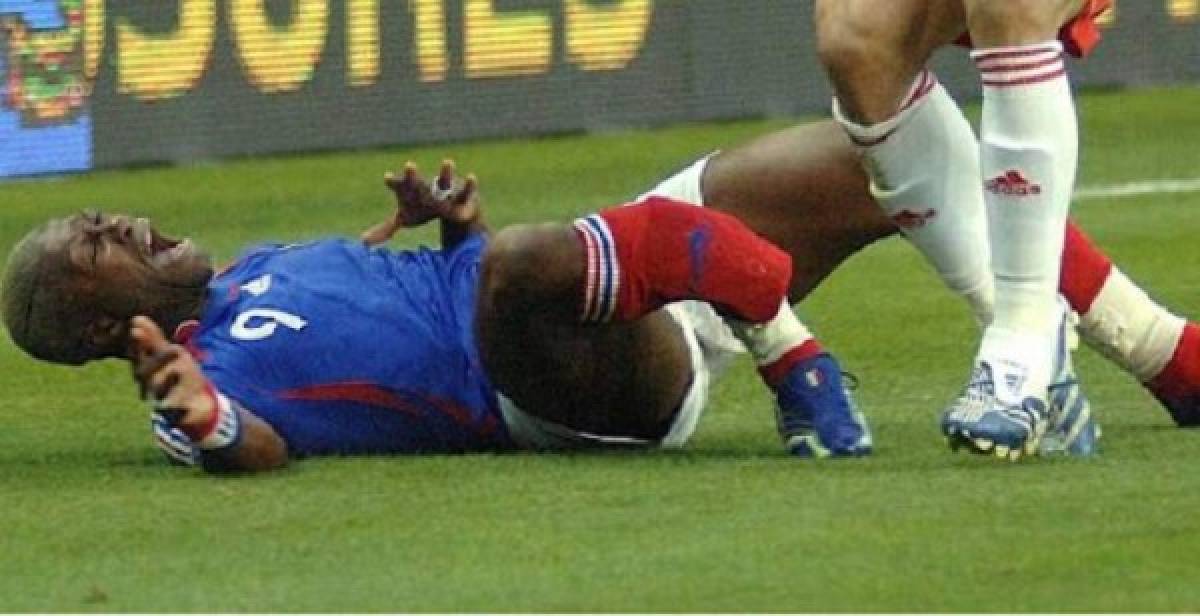 ¡De terror! Las lesiones más escalofriantes que se han visto en el mundo del fútbol