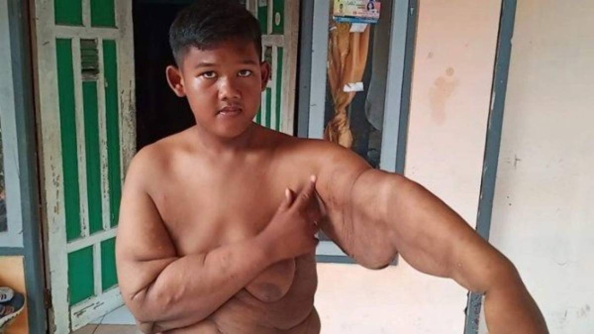 Impresionante: El tremendo cambio físico del niño más obeso del mundo que desea ser futbolista  