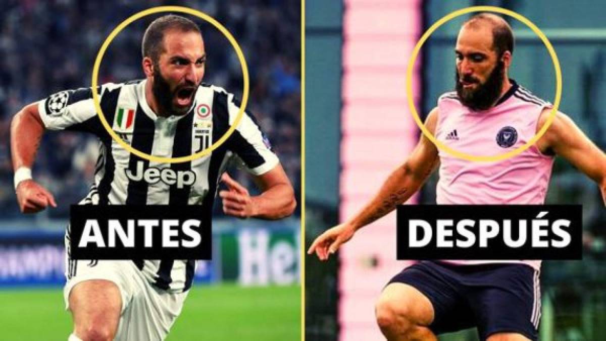 Higuaín se suma: Los looks más raros y extravagantes de los futbolistas, Cristiano también sorprendió