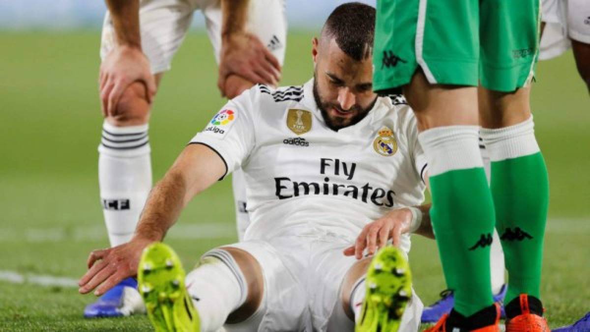 Benzema y la misteriosa lesión en su mano: Así tiene el dedo y aclara por qué no se opera