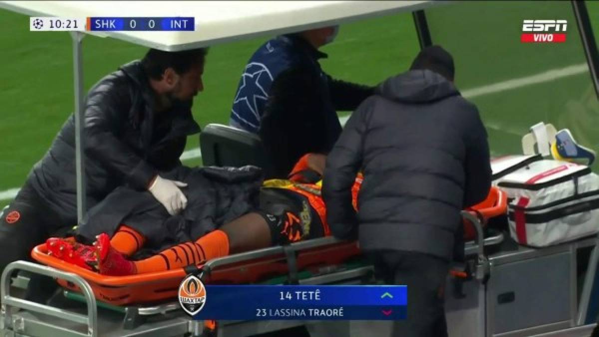 Así fue la escalofriante lesión de Lassina Traoré en la Champions; sufrimiento y lágrimas de dolor