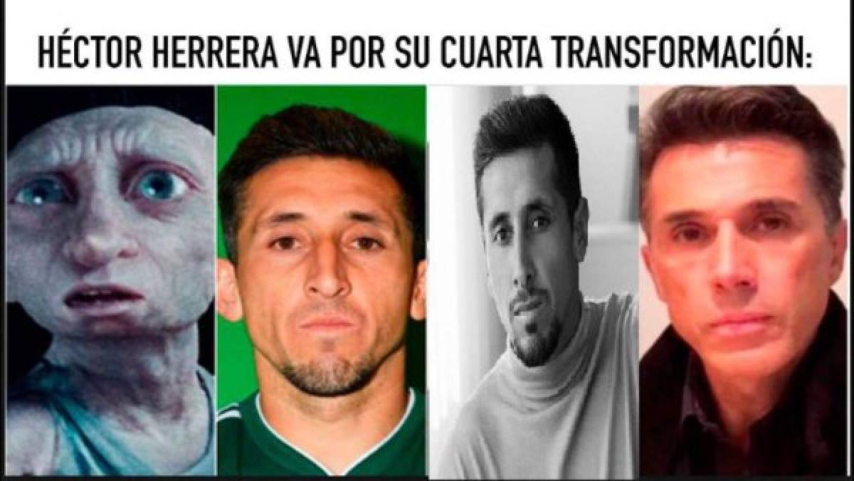 ¡Héctor Herrera es acribillado con memes tras sus cirugías plásticas!