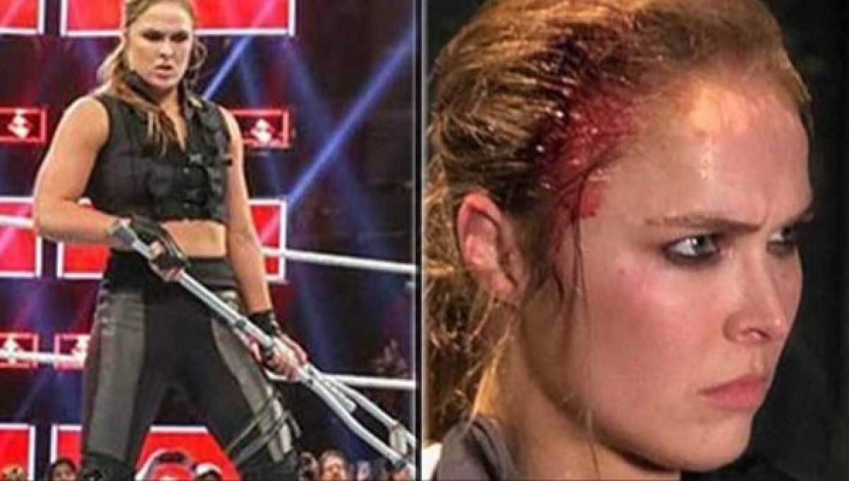 ¡Impactante! Así quedó el rostro de Ronda Rousey tras una pelea de 'muletazos' en WWE