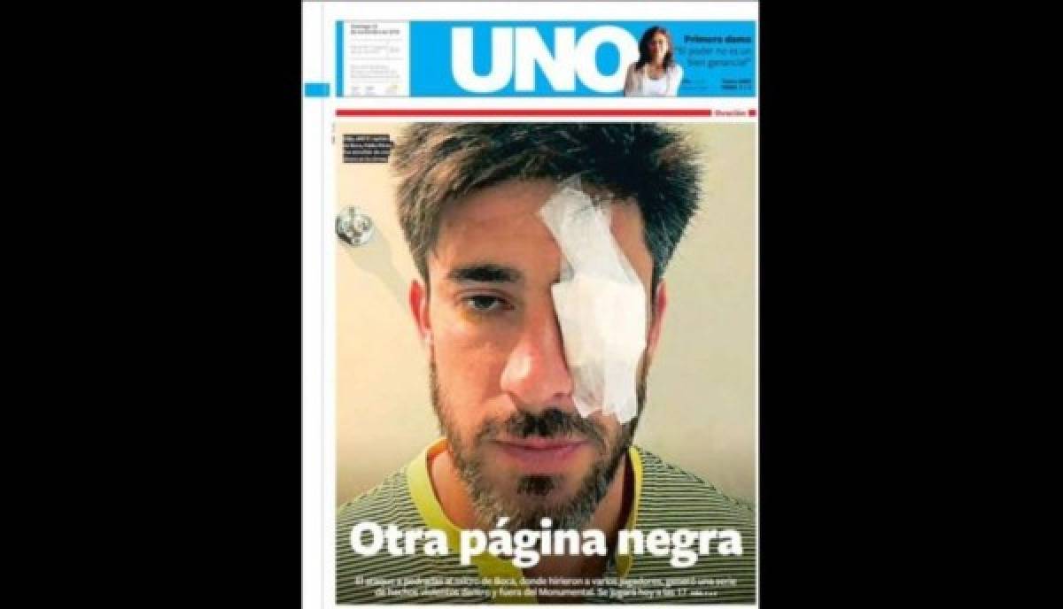 Pelotudos y la copa rota: Las portadas del escándalo del River Plate-Boca Juniors