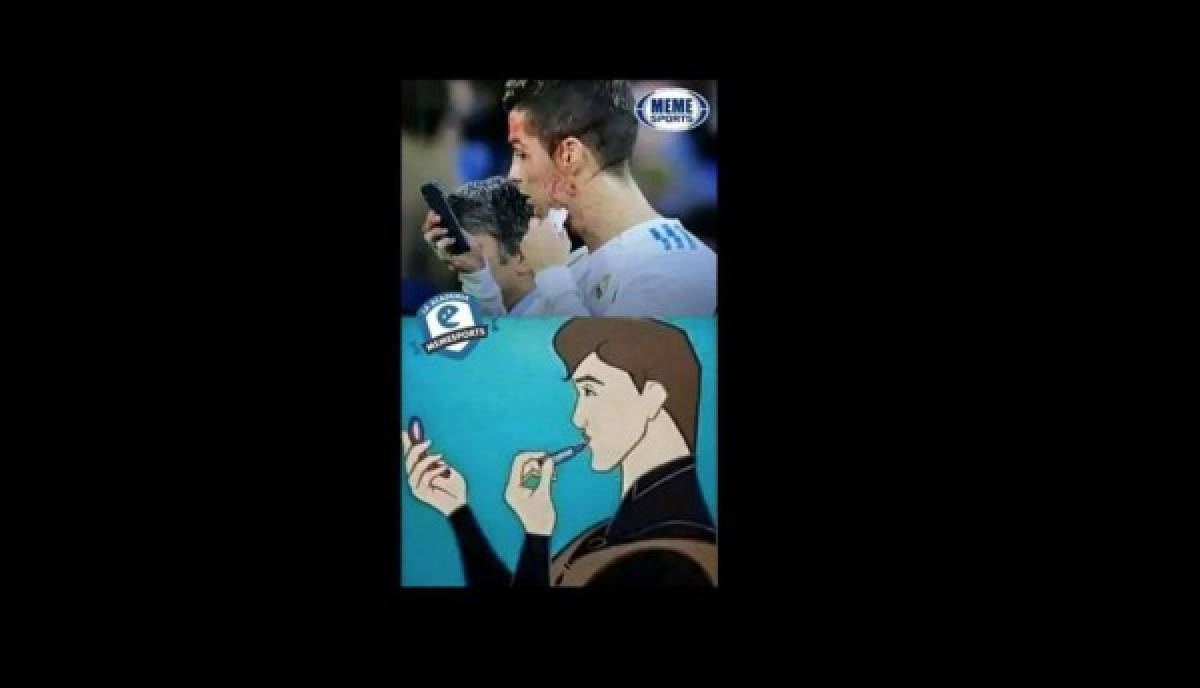 ¡VIRAL! Los memes de Cristiano Ronaldo por mirar su herida en el celular