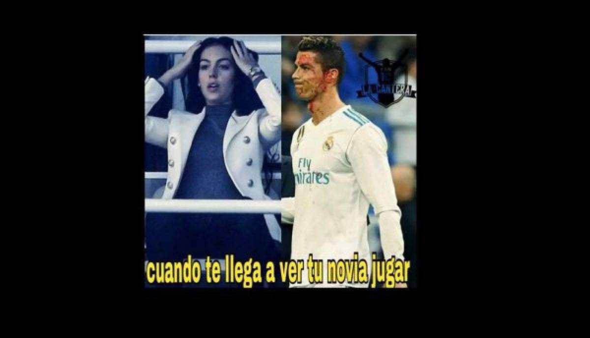 ¡VIRAL! Los memes de Cristiano Ronaldo por mirar su herida en el celular