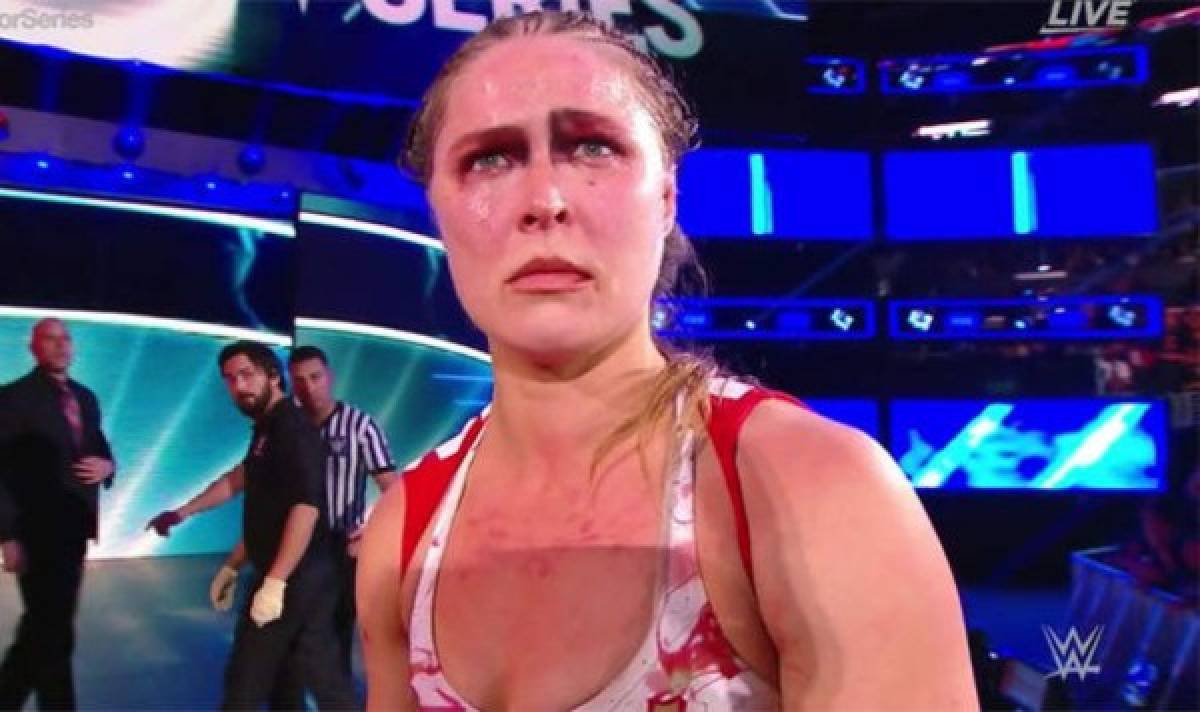 Ronda Rousey muestra sus impactantes lesiones tras la paliza en la WWE