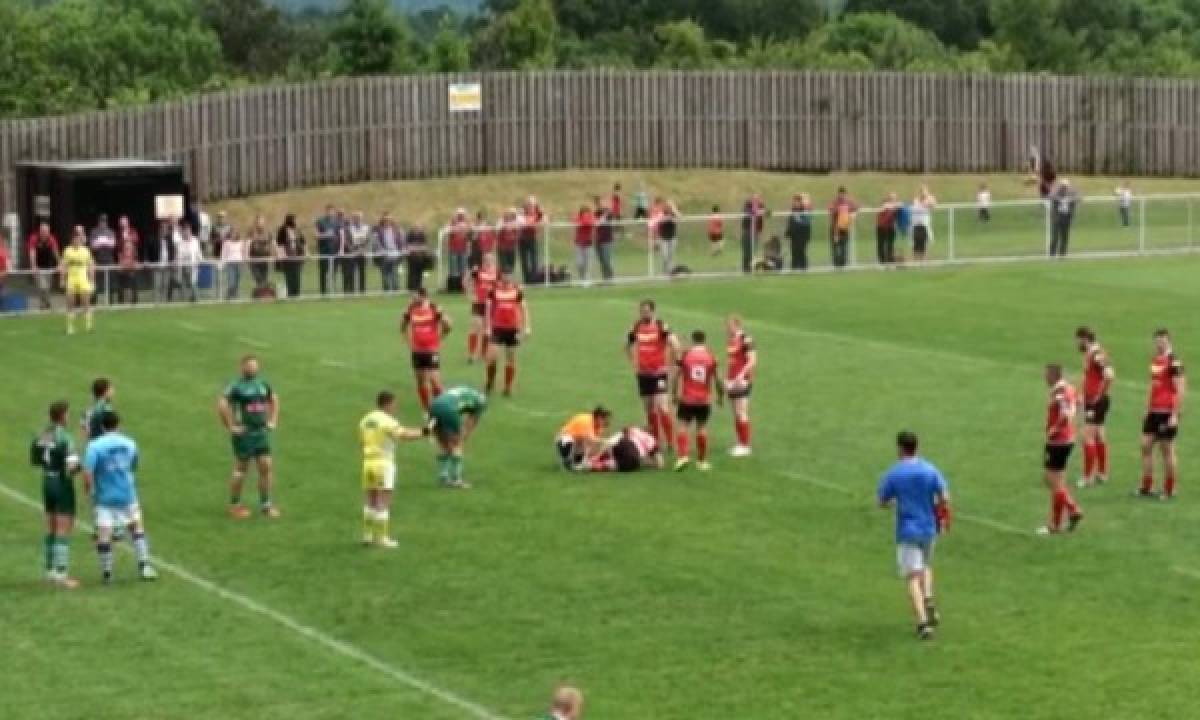 VIDEO: La espantosa lesión de Alex Thompson, jugador de rugby