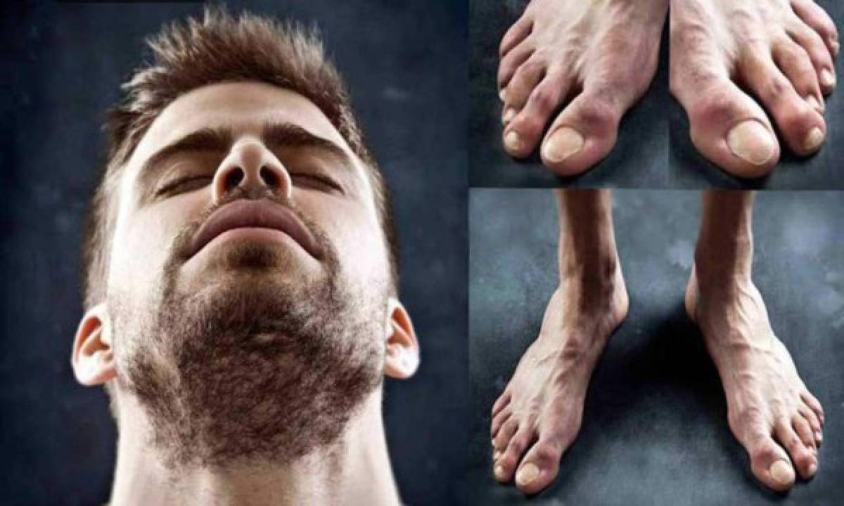 Horribles: Así son los pies más feos de los mejores futbolistas del mundo; Müller se une a la lista