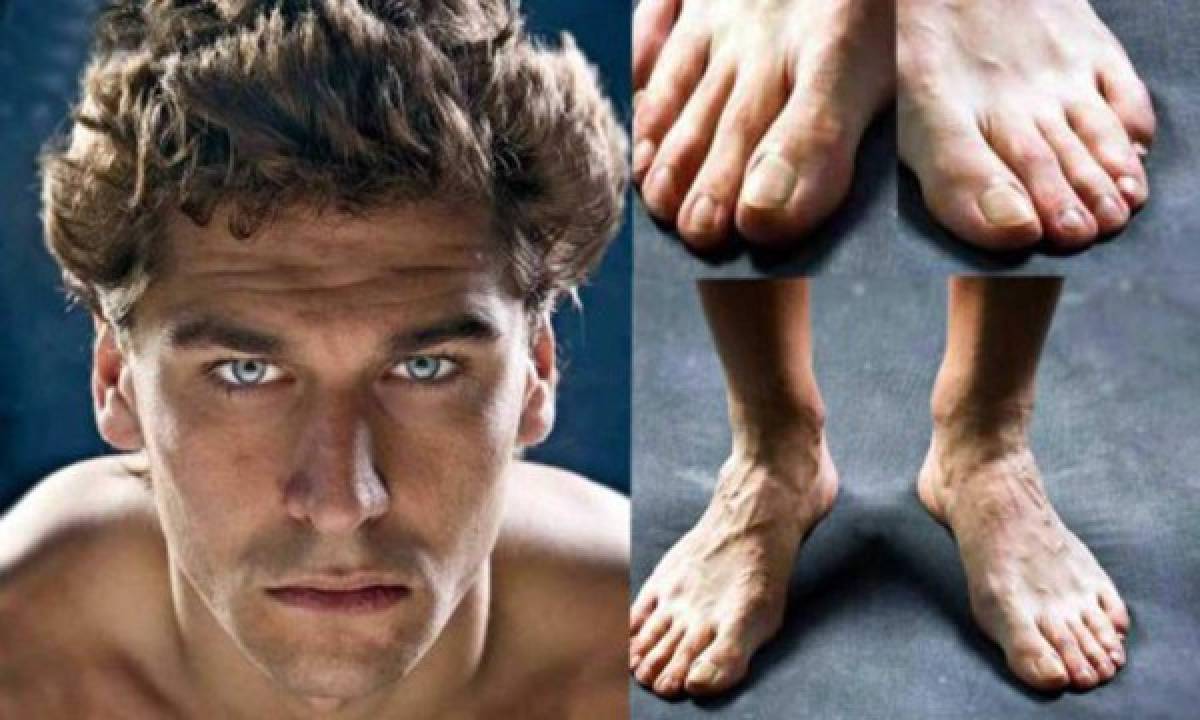 FOTOS: Así son los pies más feos de algunos deportistas reconocidos