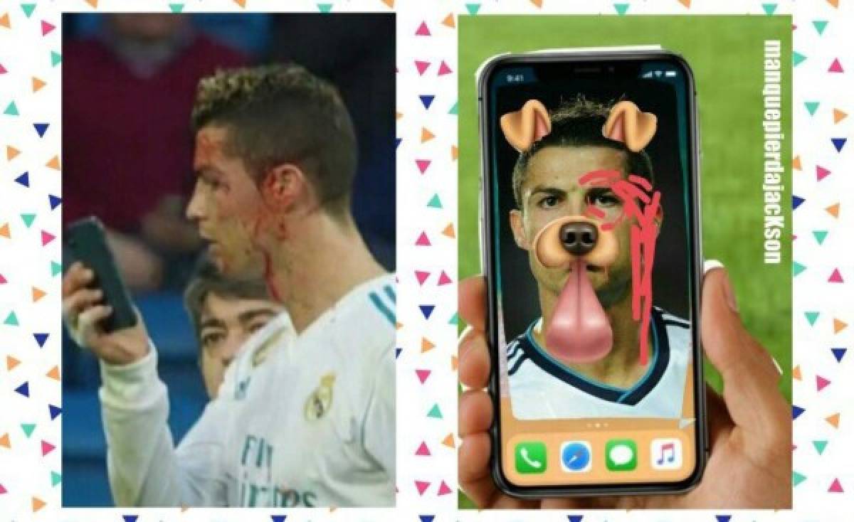 ¡VIRAL! Los memes de Cristiano Ronaldo por mirar su herida en el celular