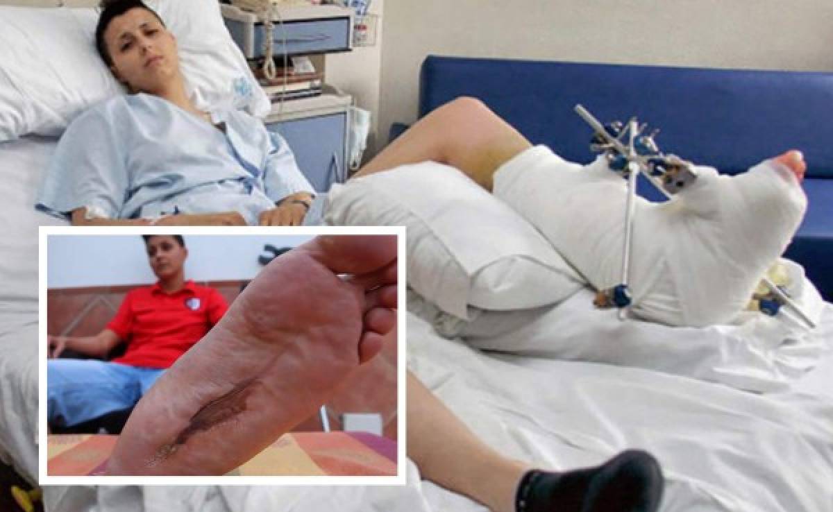 La vigilante de seguridad que perdió su pie durante un Barça-Inter en 2010 clama ayuda