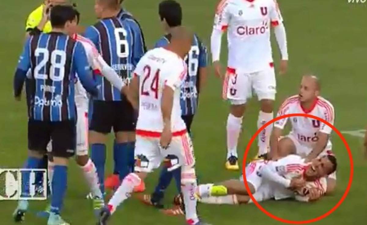 VIDEO: Brutal lesión de futbolista chileno en la Copa Sudamericana