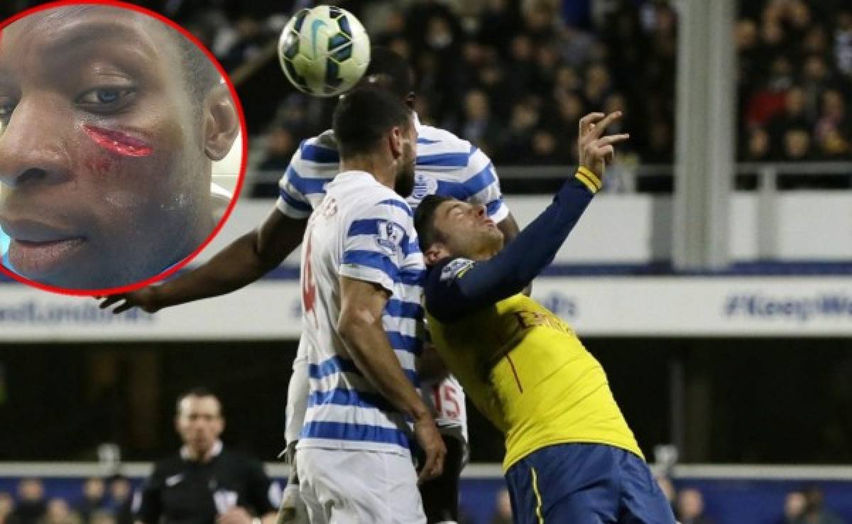 Escalofriante herida en rostro de jugador del QPR tras chocar con compañero