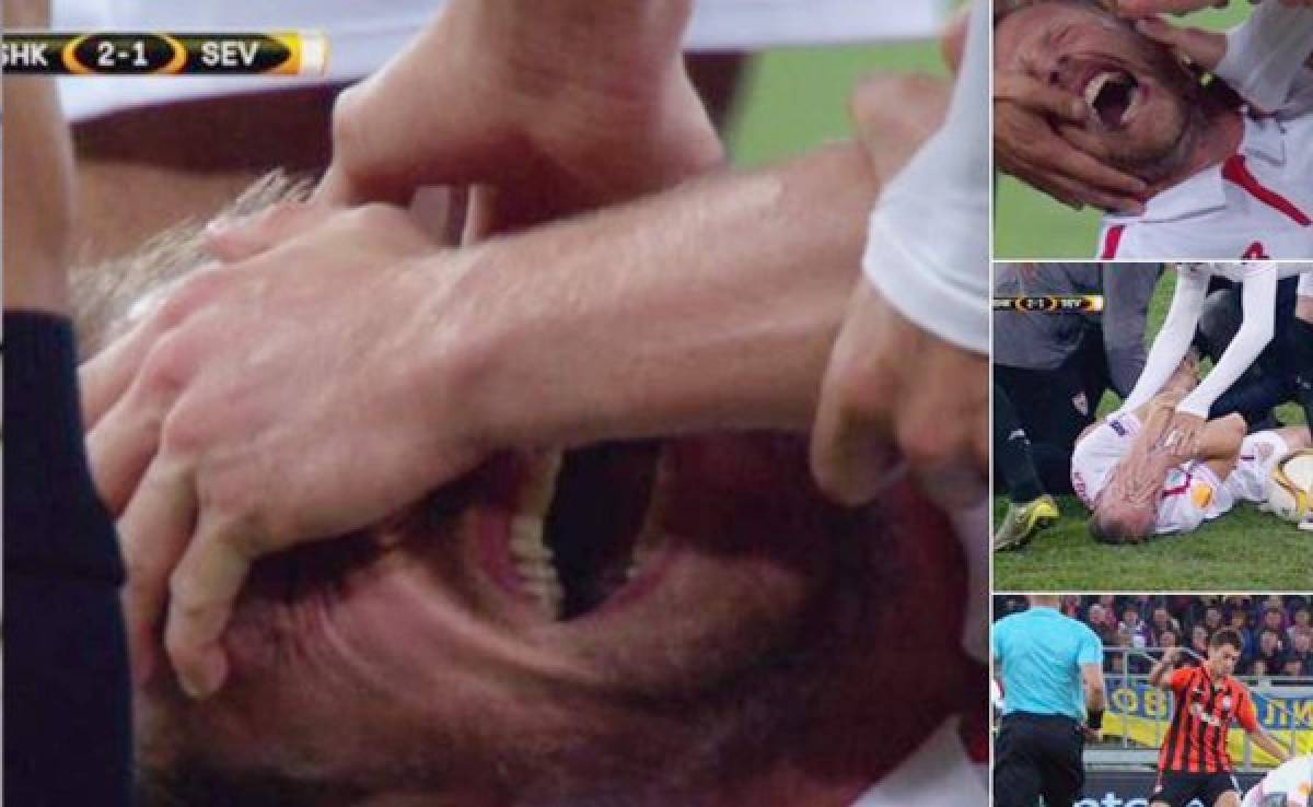 VIDEO: La aterradora lesión que sufre el danés Krohn-Dehli con el Sevilla
