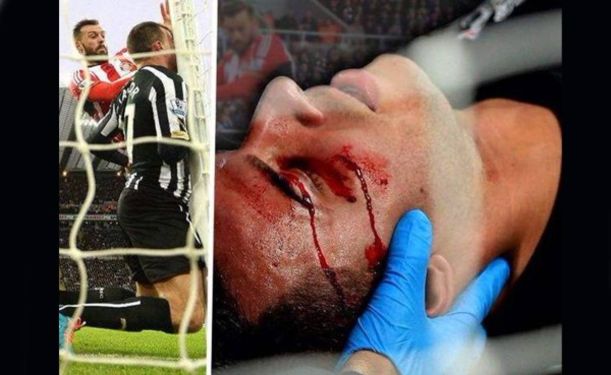 VIDEO: Jugador del Newcastle sufre brutal golpe con el poste