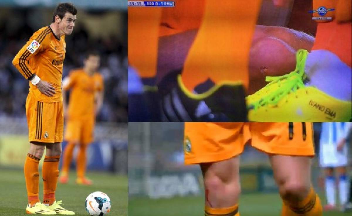 VIDEO: Gareth Bale terminó con un agujero en su rodilla