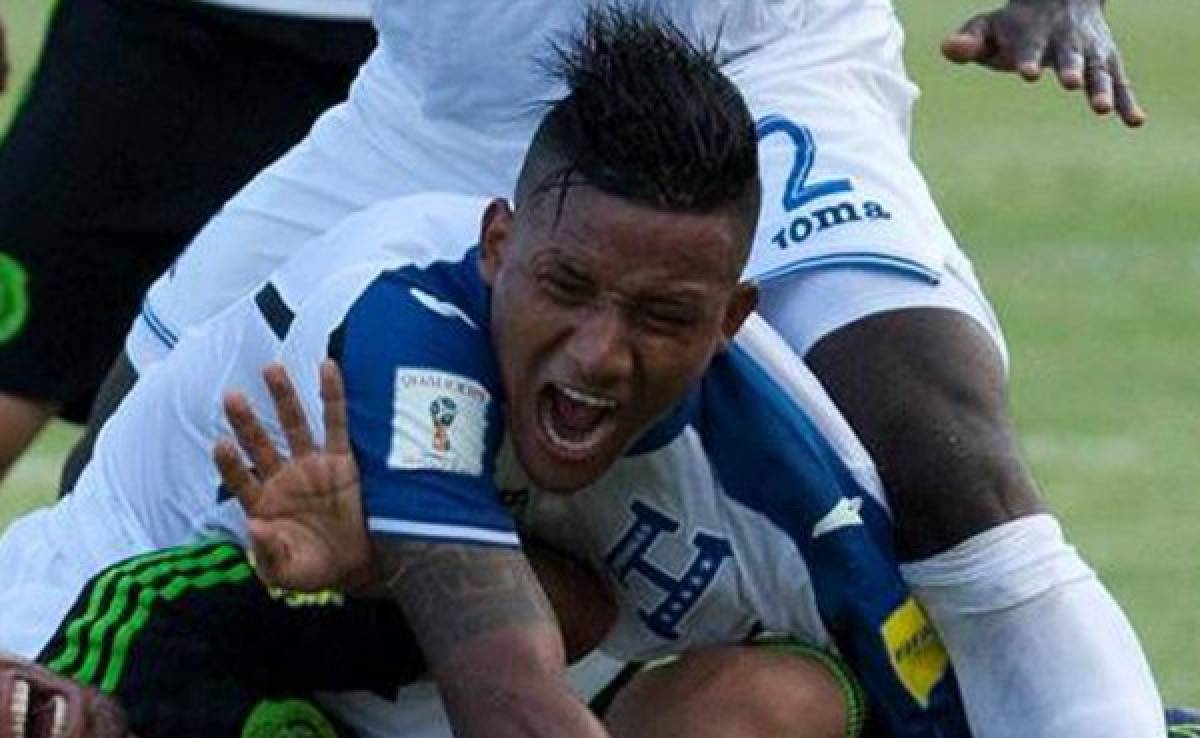 TOP 5: El hondureño Luis Garrido dentro de las lesiones más impactantes del fútbol