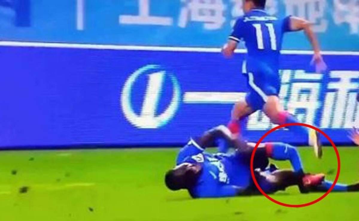 VIDEO: Terrible lesión de Demba Ba en el fútbol de China