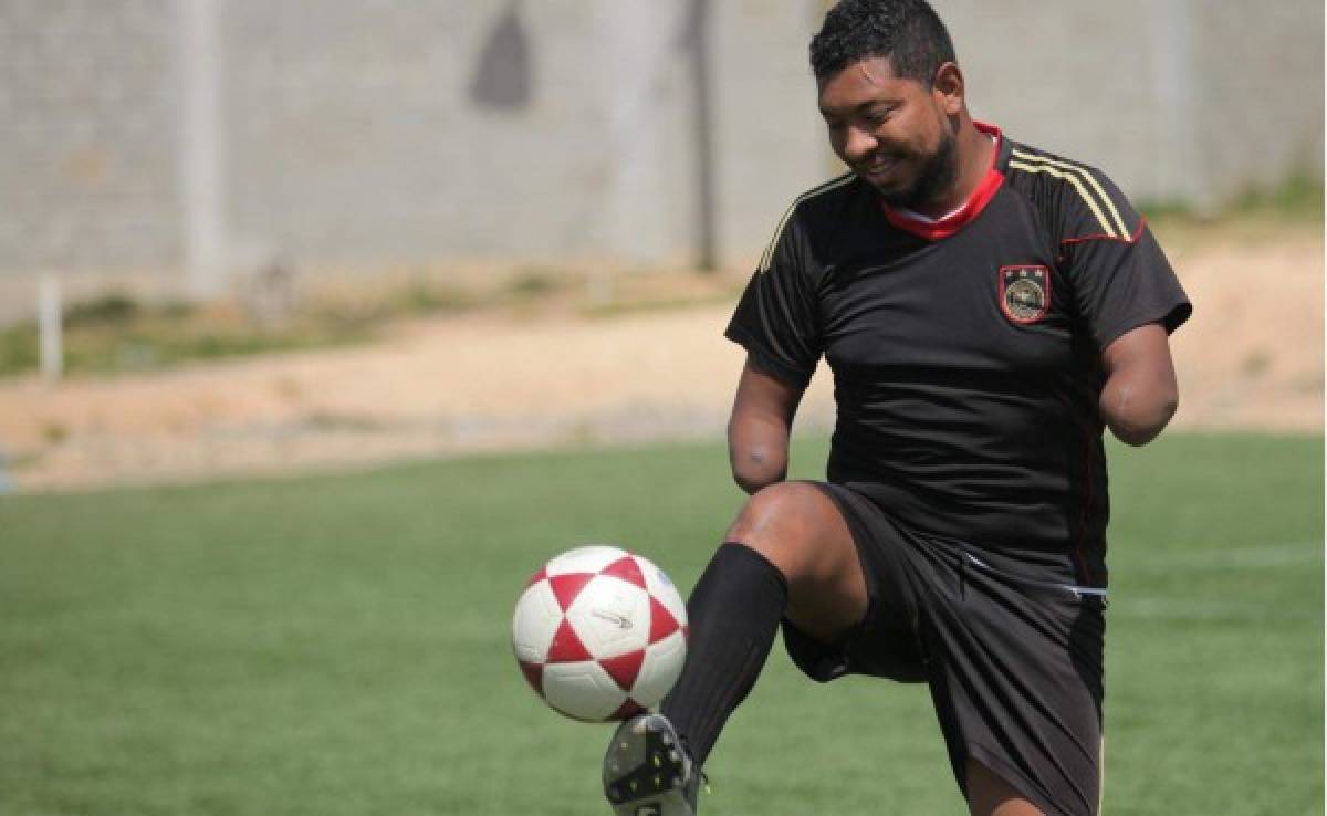 Olvin, el futbolista hondureño que juega sin manos