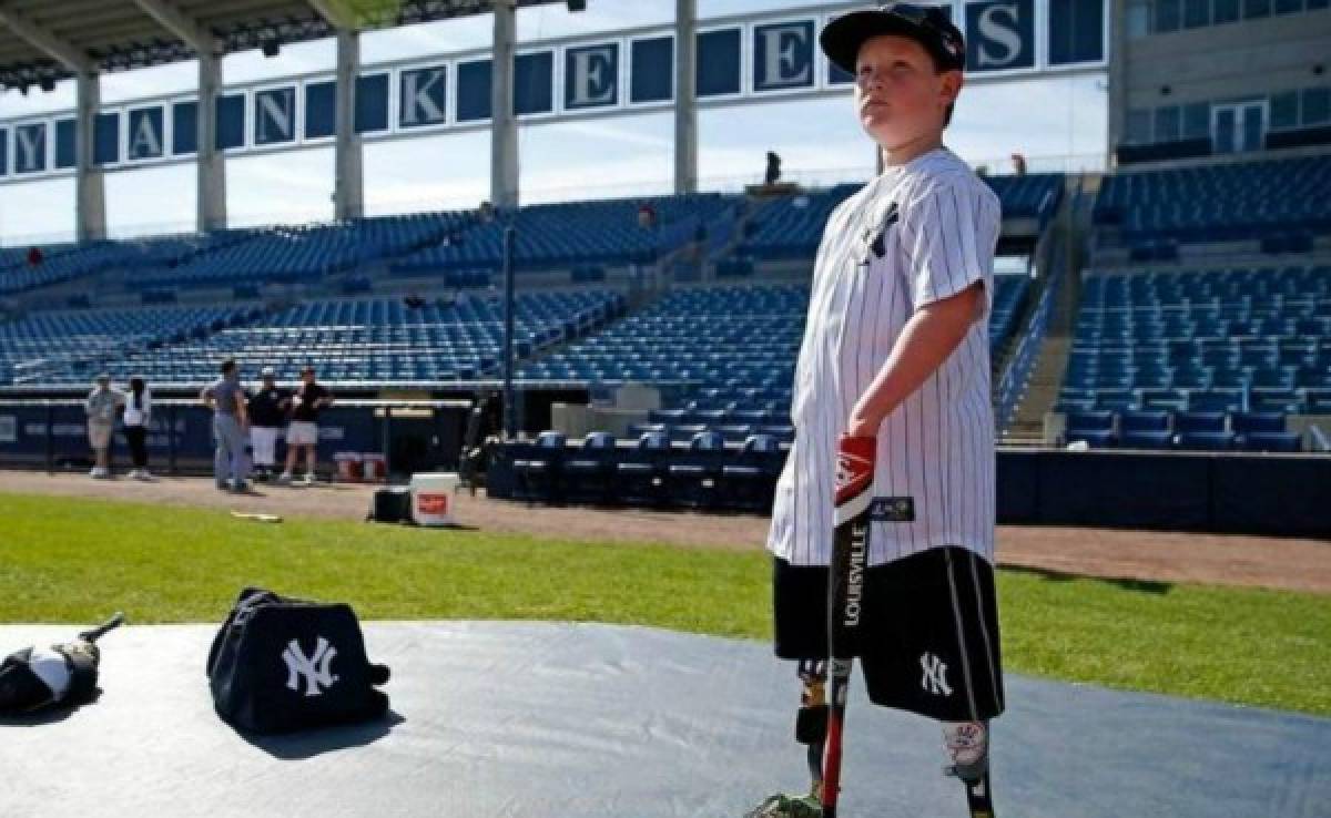 Los Yankees de New York contrataron a un niño sin manos