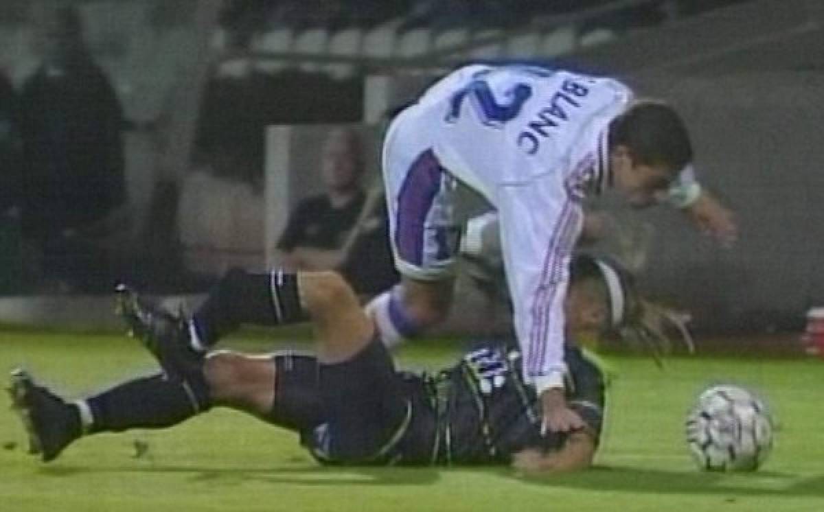 Las lesiones más escalofriantes que se han dado en el fútbol, André Gomes el último  