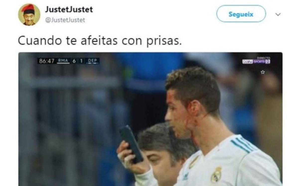 ¡VIRAL! Los memes de Cristiano Ronaldo por mirar su herida en el celular