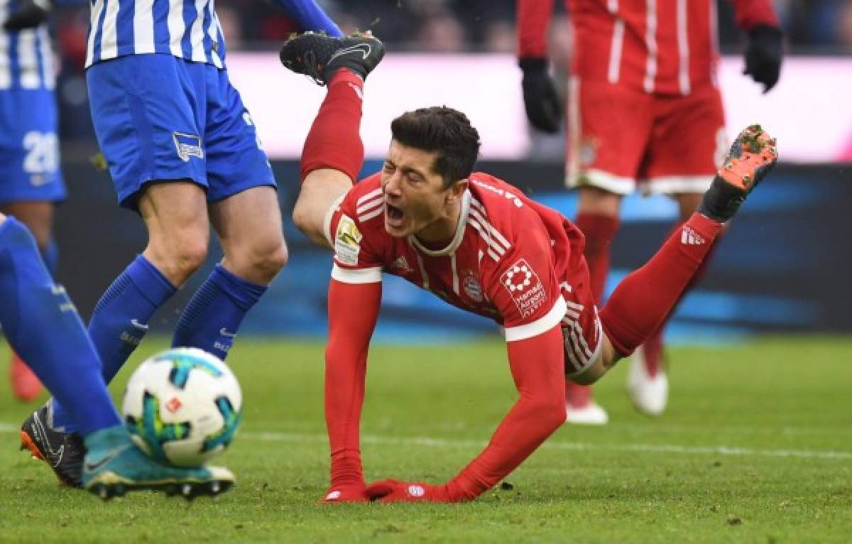 MUN001. Munich (Germany), 24/02/2018.- Bayern's Robert Lewandowksi reacts during the German Bundesliga soccer match between FC Bayern Munich and Hertha BSC Berlin, in Munich, Germany, 24 February 2018. (Alemania) EFE/EPA/LUKAS BARTH EMBARGO CONDITIONS - ATTENTION: Due to the accreditation guidlines, the DFL only permits the publication and utilisation of up to 15 pictures per match on the internet and in online media during the match.