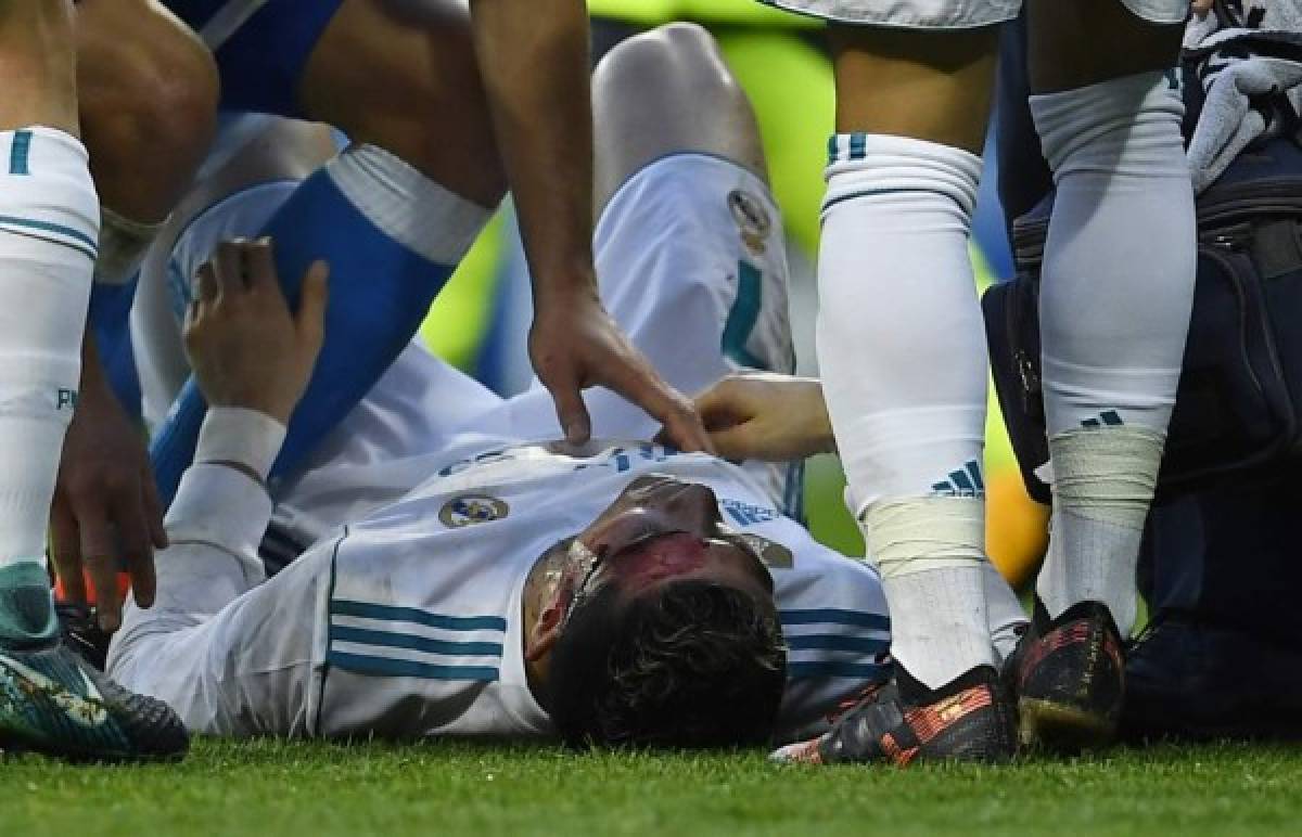 Real Madrid's Portuguese forward Cristiano Ronaldo (down) lies on the field after sustaining an injury during the Spanish league football match between Real Madrid CF and RC Deportivo de la Coruna at the Santiago Bernabeu stadium in Madrid on January 21, 2018. / AFP PHOTO / OSCAR DEL POZO