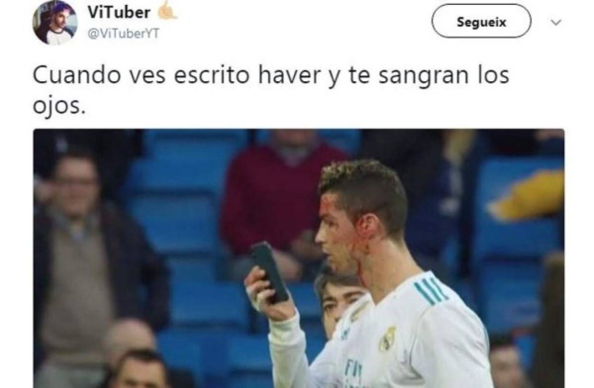 ¡VIRAL! Los memes de Cristiano Ronaldo por mirar su herida en el celular