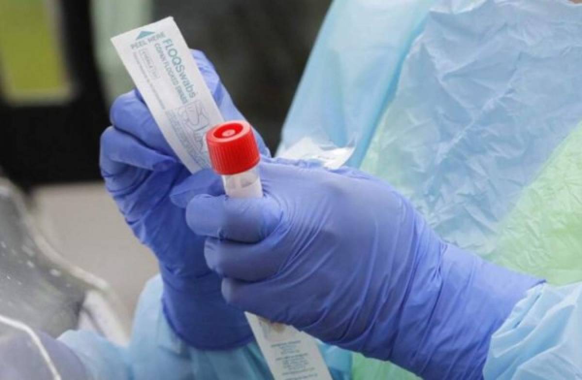 Dañadas 250 mil pruebas para coronavirus a un costo de 46 millones de lempiras