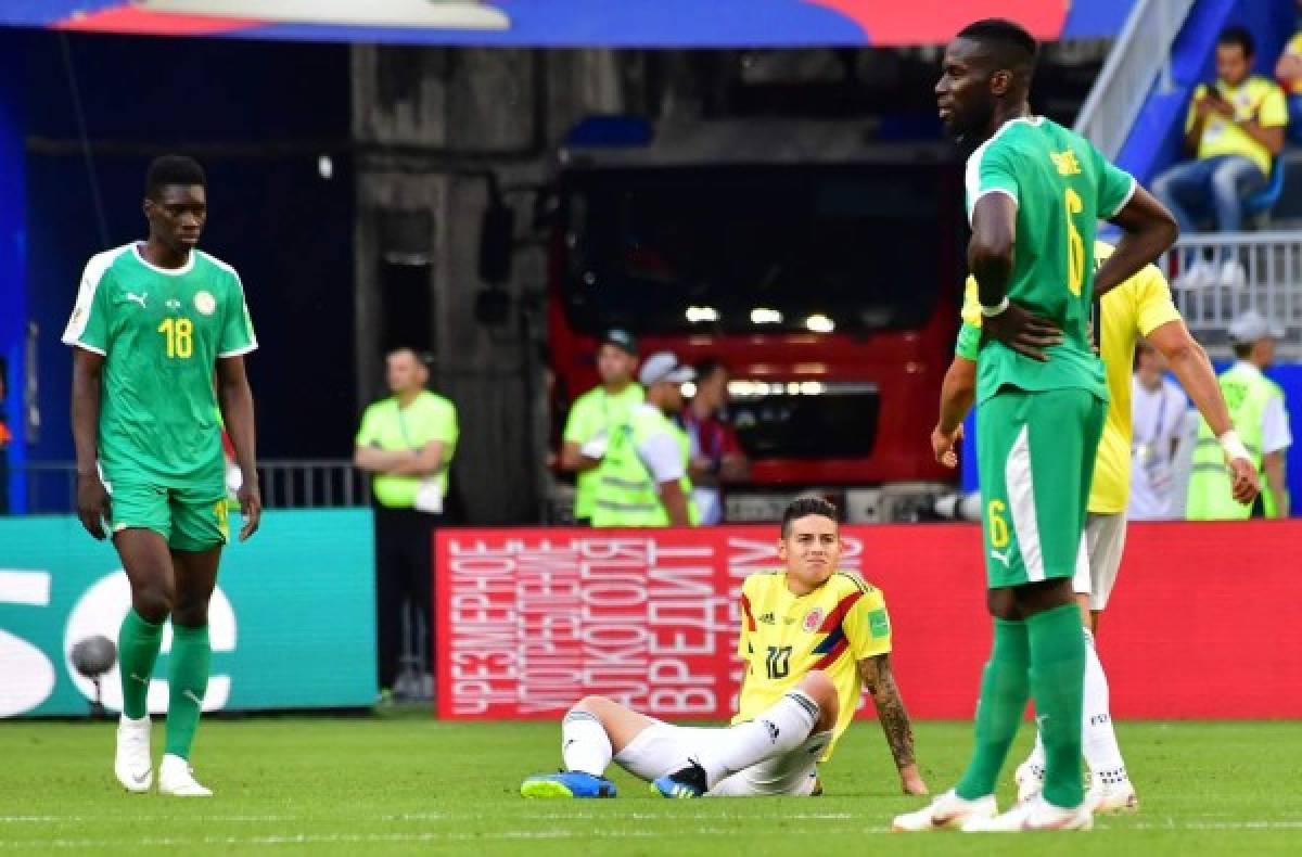 Colombia's midfielder James Rodriguez (C) sits on the ground after being injured during the Russia 2018 World Cup Group H football match between Senegal and Colombia at the Samara Arena in Samara on June 28, 2018. / AFP PHOTO / Luis Acosta / RESTRICTED TO EDITORIAL USE - NO MOBILE PUSH ALERTS/DOWNLOADS