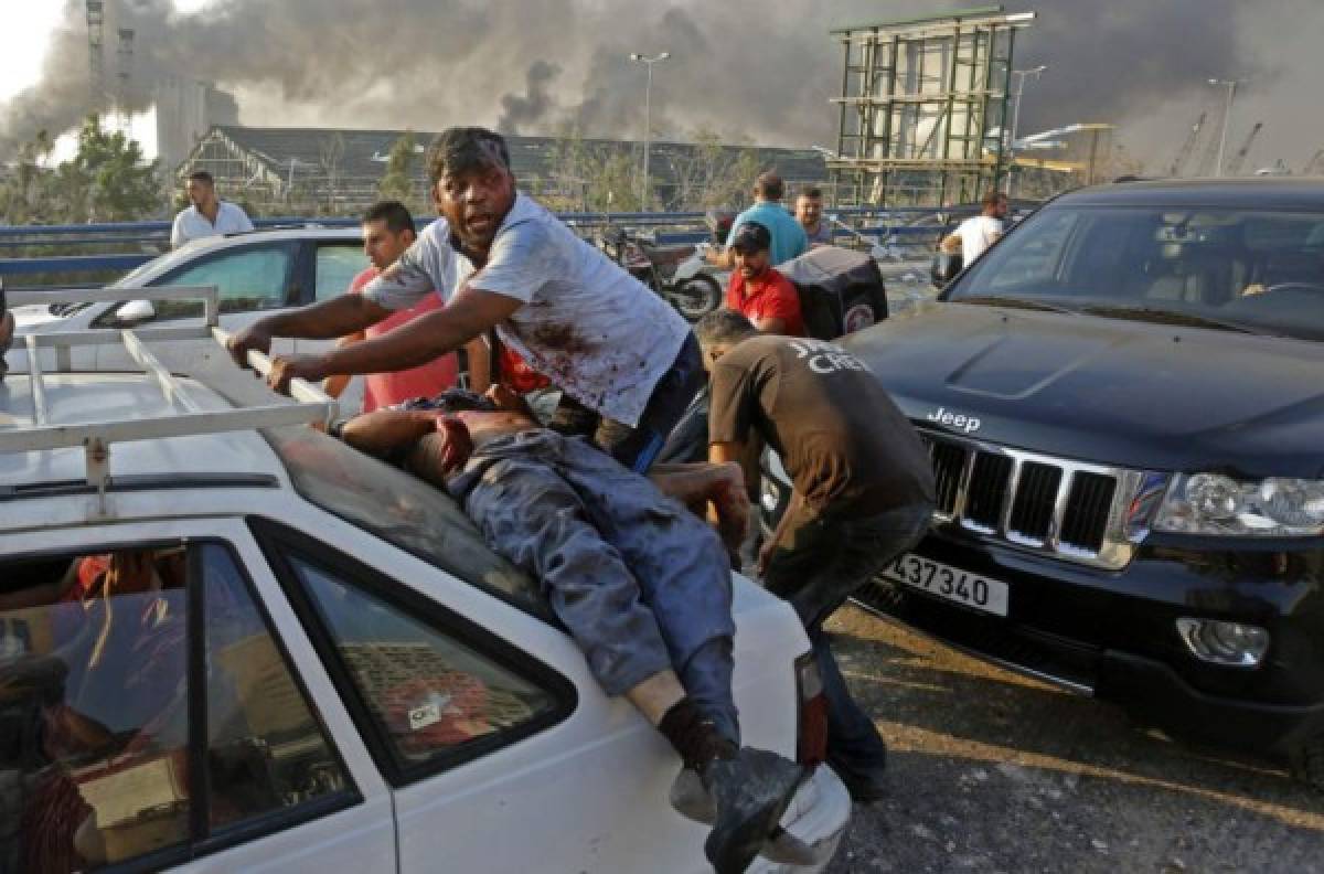 Lágrimas y muertos: Las impactantes nuevas imágenes de las explosiones en Beirut, Líbano