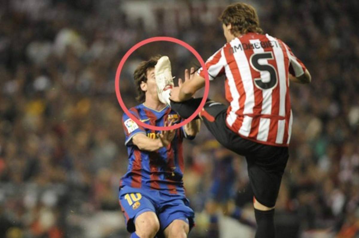 Amorebieta: ''Messi fue el que se resbaló y chocó contra mi pie''