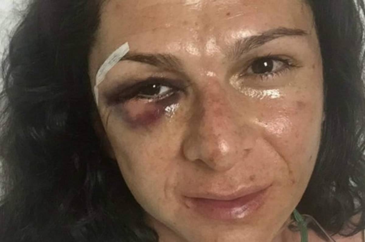 VIDEO: Así fue brutalmente agredida la exatleta mexicana Ana Guevara