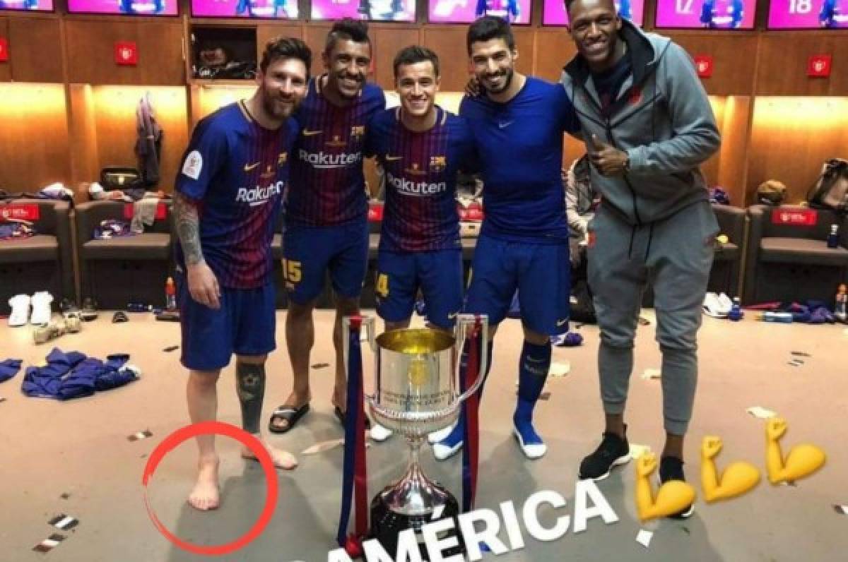¡Increíble! La foto que 'confirma' que Messi tiene seis dedos en un pie
