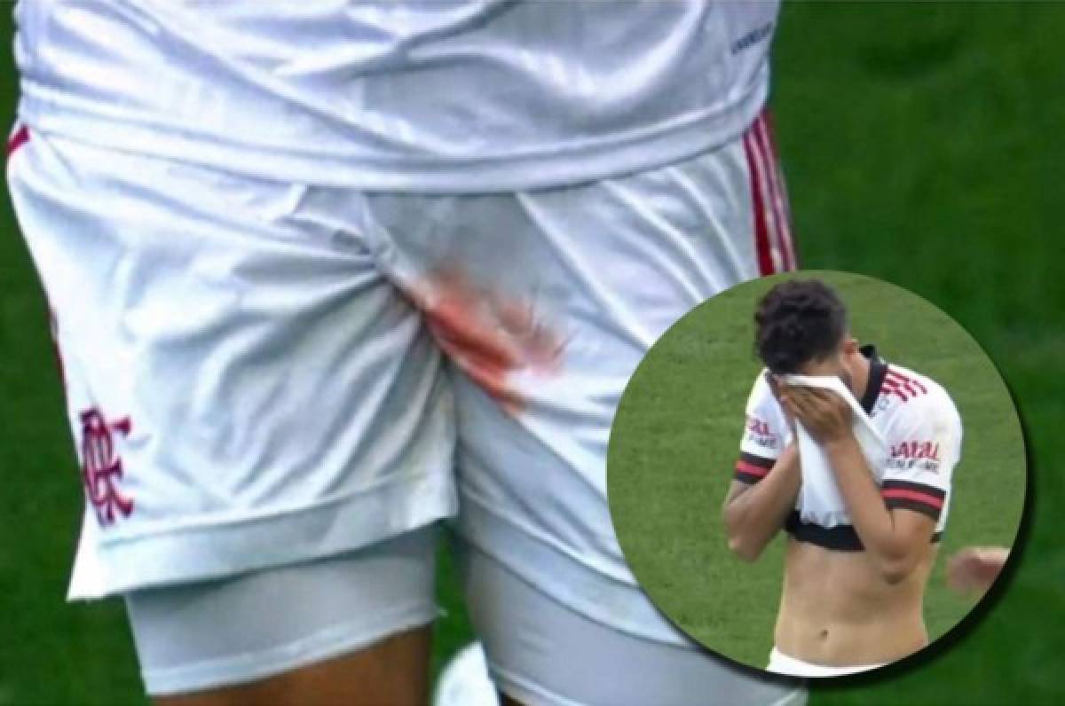 Futbolista del Flamengo sufre terrorífica lesión: deja llorando la cancha por un corte en un testículo