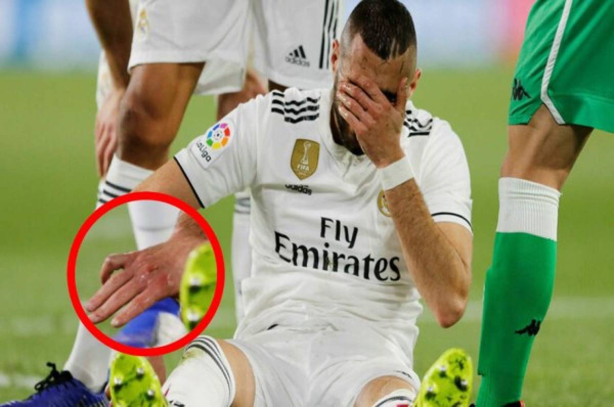 La terrible lesión de Karim Benzema ante el Real Betis en La Liga