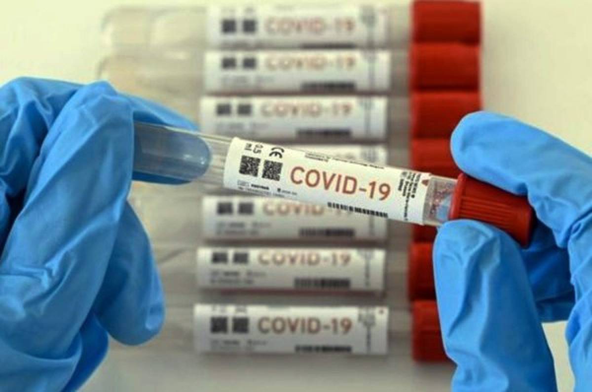OPS anuncia nuevas pruebas rápidas de antígenos para detectar con mayor rapidez y precisión el covid-19
