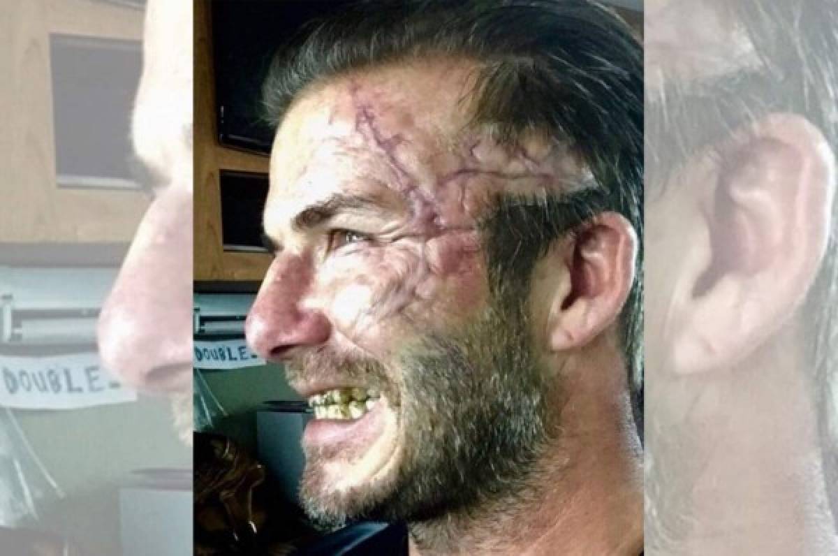 Irreconocible: Así se encuentra el rostro de David Beckham