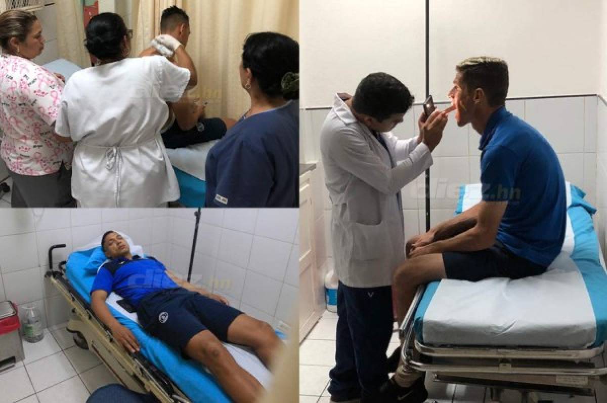 Jugadores heridos del Motagua tras ataque a autobús reciben el alta médica