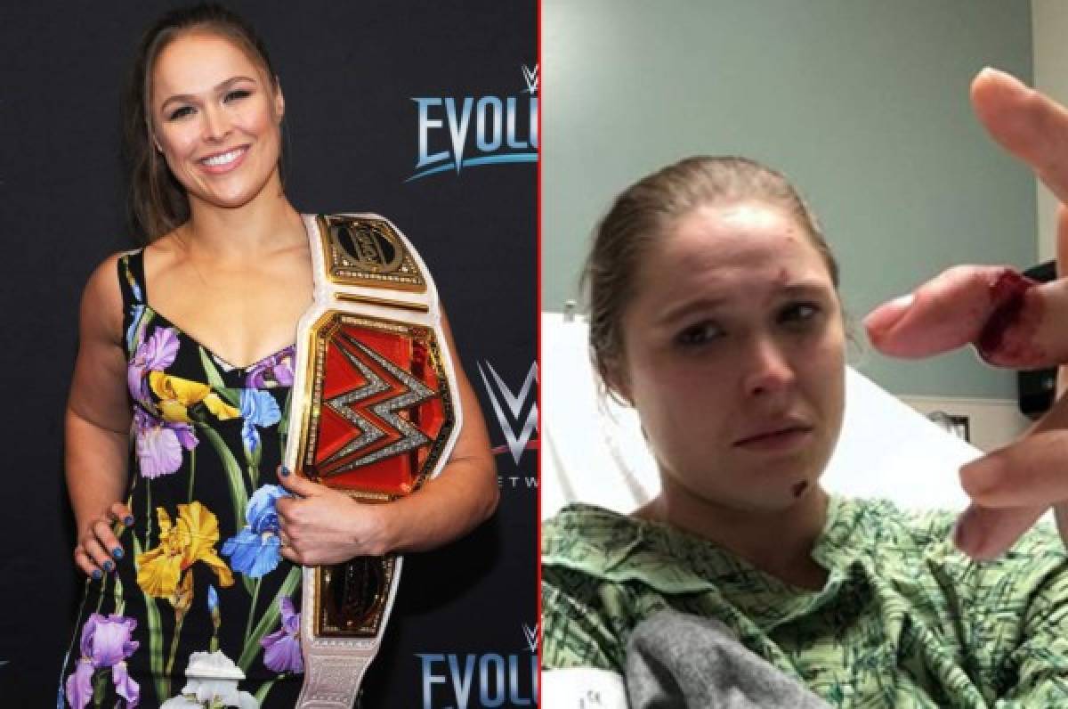 Impactante: Ronda Rousey casi pierde un dedo mientras filmaba en una serie