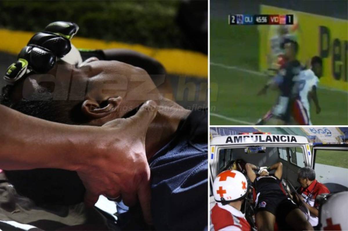 VIDEO: Donis Escober sufre fractura en el rostro y sale del Nacional en ambulancia